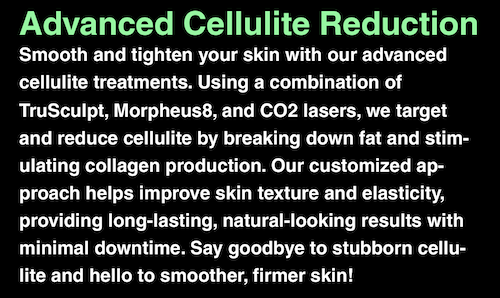 Cellulite Treatments TruSculpt Morpheus8 CO2 Laser Mississauga Oakville